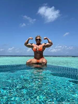 Amymuscle