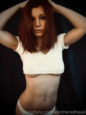 anntheredhead