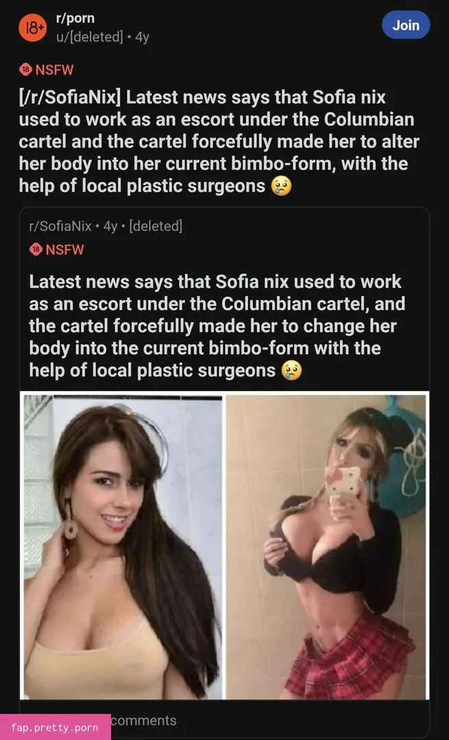 Before and After : Pornstar Boobjobs - Photo #22