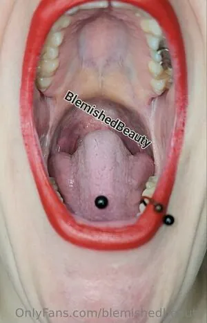 blemishedbeauty