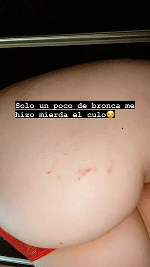 Bun1aca