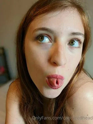 candyredhead