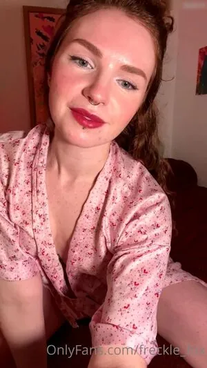 freckle_fox
