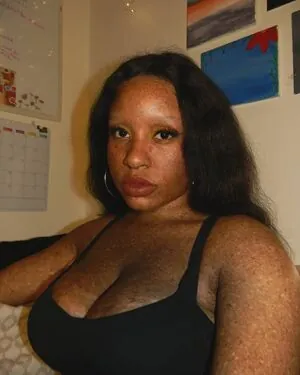 freckledn