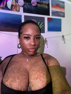 freckledn