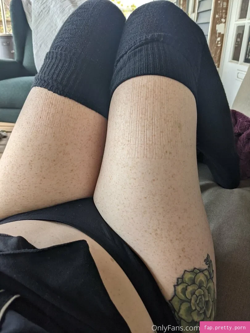 frecksfordays - Photo #11