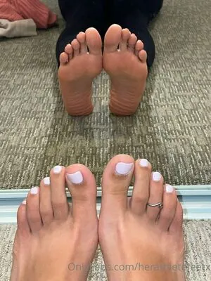 herathletefeetxo