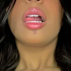 medusacero