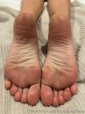 myposedtoes