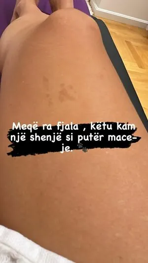 Rudina Dembacaj
