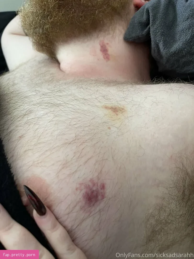 sicksadsarahh - Photo #29