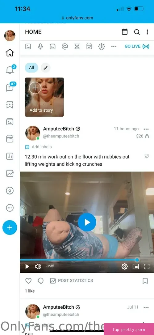 theamputeebitch - Photo #50