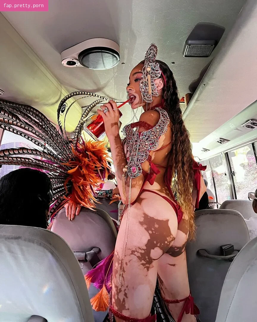 Winnie Harlow - Photo #44