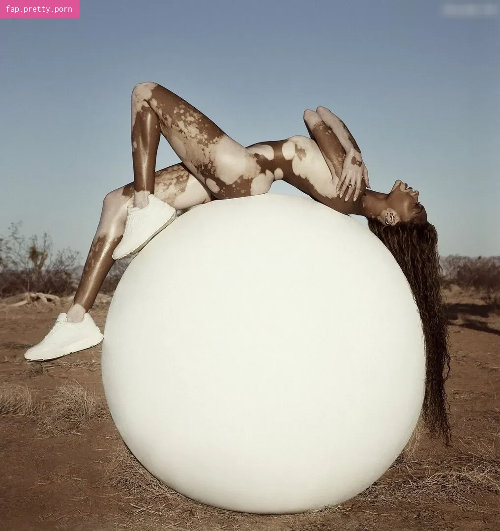 Winnie Harlow - Photo #64