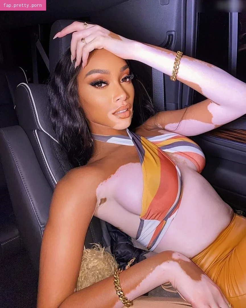 Winnie Harlow - Photo #71