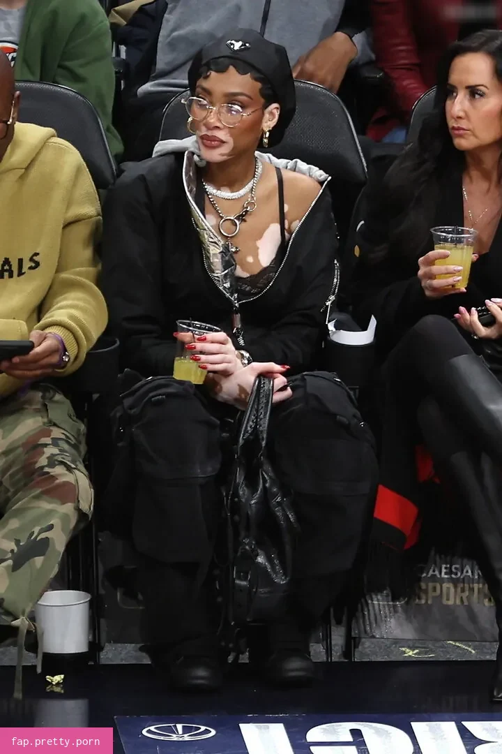 Winnie Harlow - Photo #21