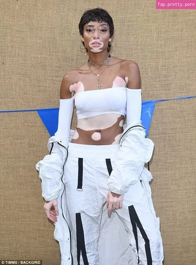 Winnie Harlow - Photo #49