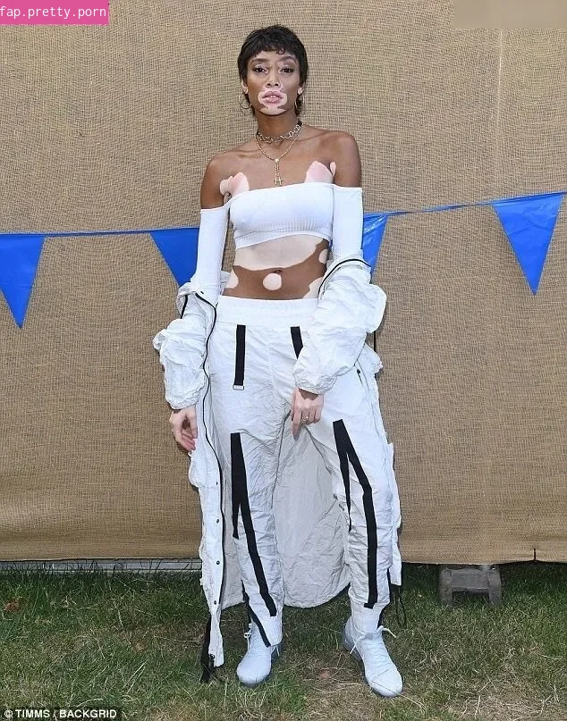 Winnie Harlow - Photo #52