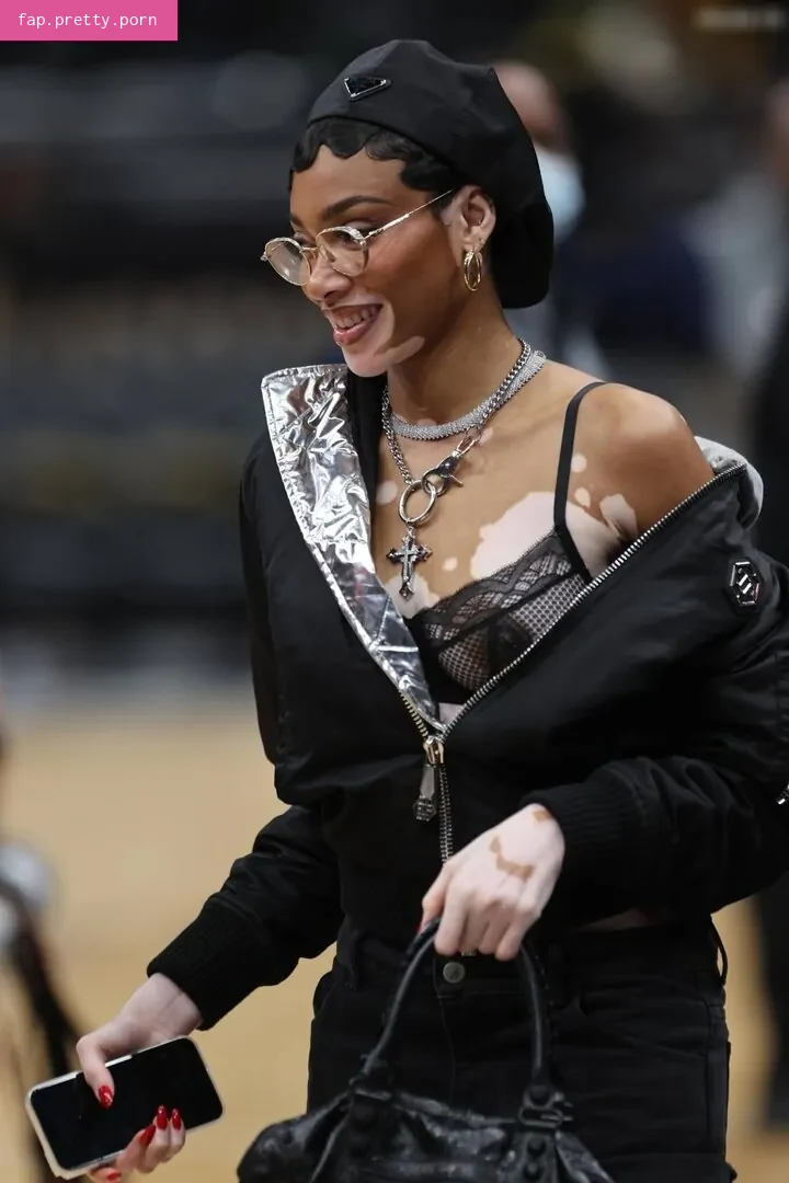 Winnie Harlow - Photo #72